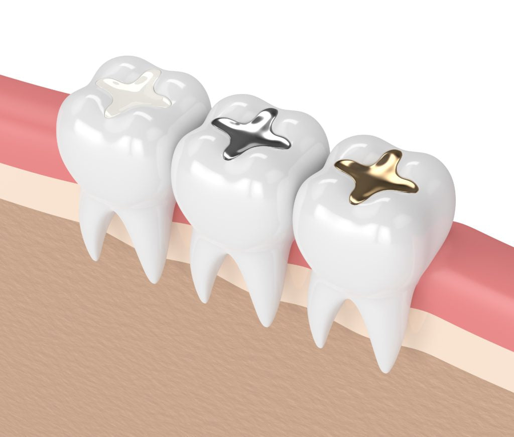 How do fillings work?
