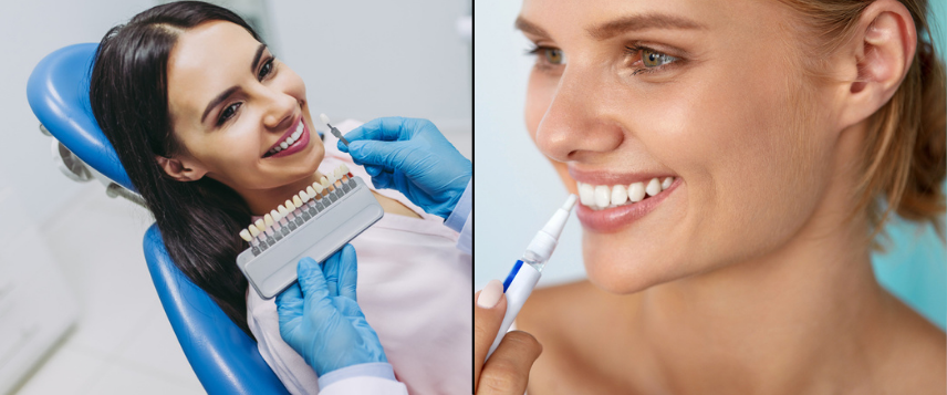 Can I whiten my teeth without going to the dentist?