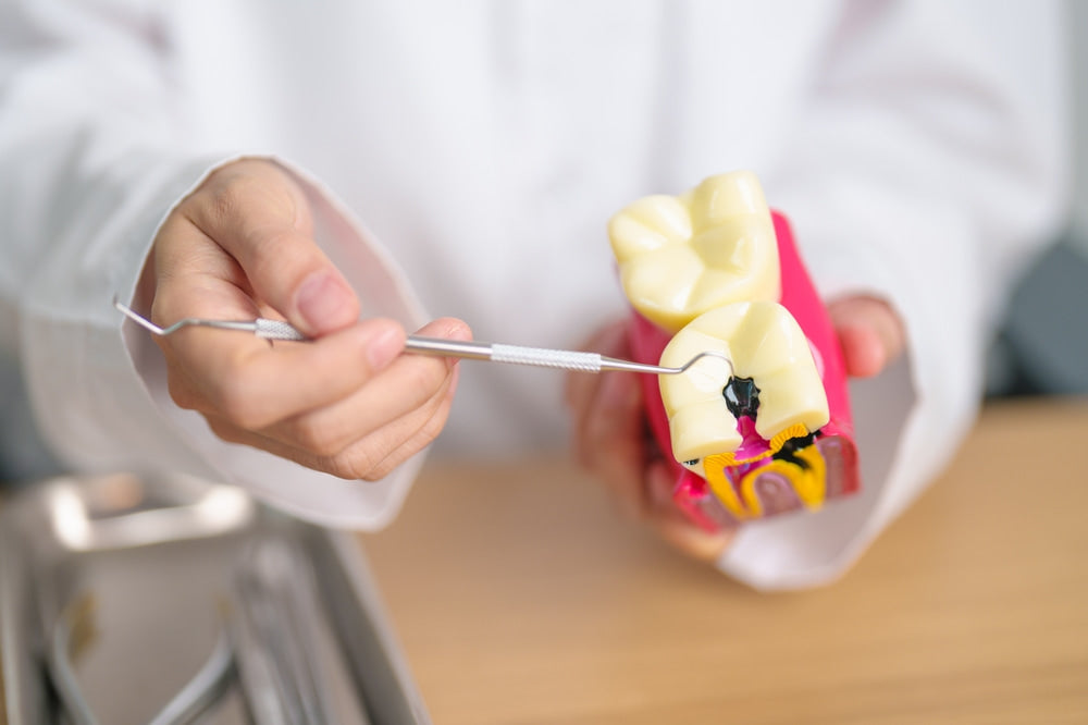 Cavities & Tooth Decay - Symptoms, Causes & Treatments