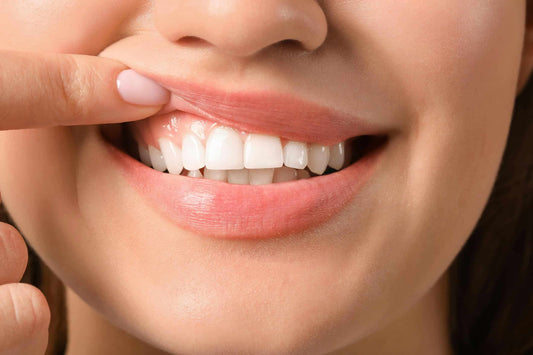 Discoloured Gums: All the Symptoms, Causes & the Right Treatment