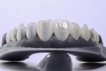 Composite Bonding vs Porcelain Veneers – Which Is Better?