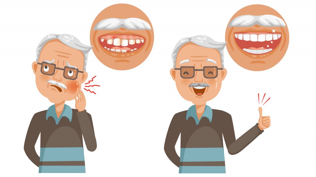 A Mini Smile Makeover at any age