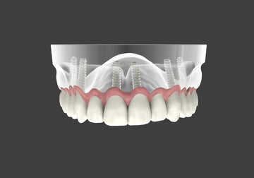 What are Same Day Teeth and who are they for?